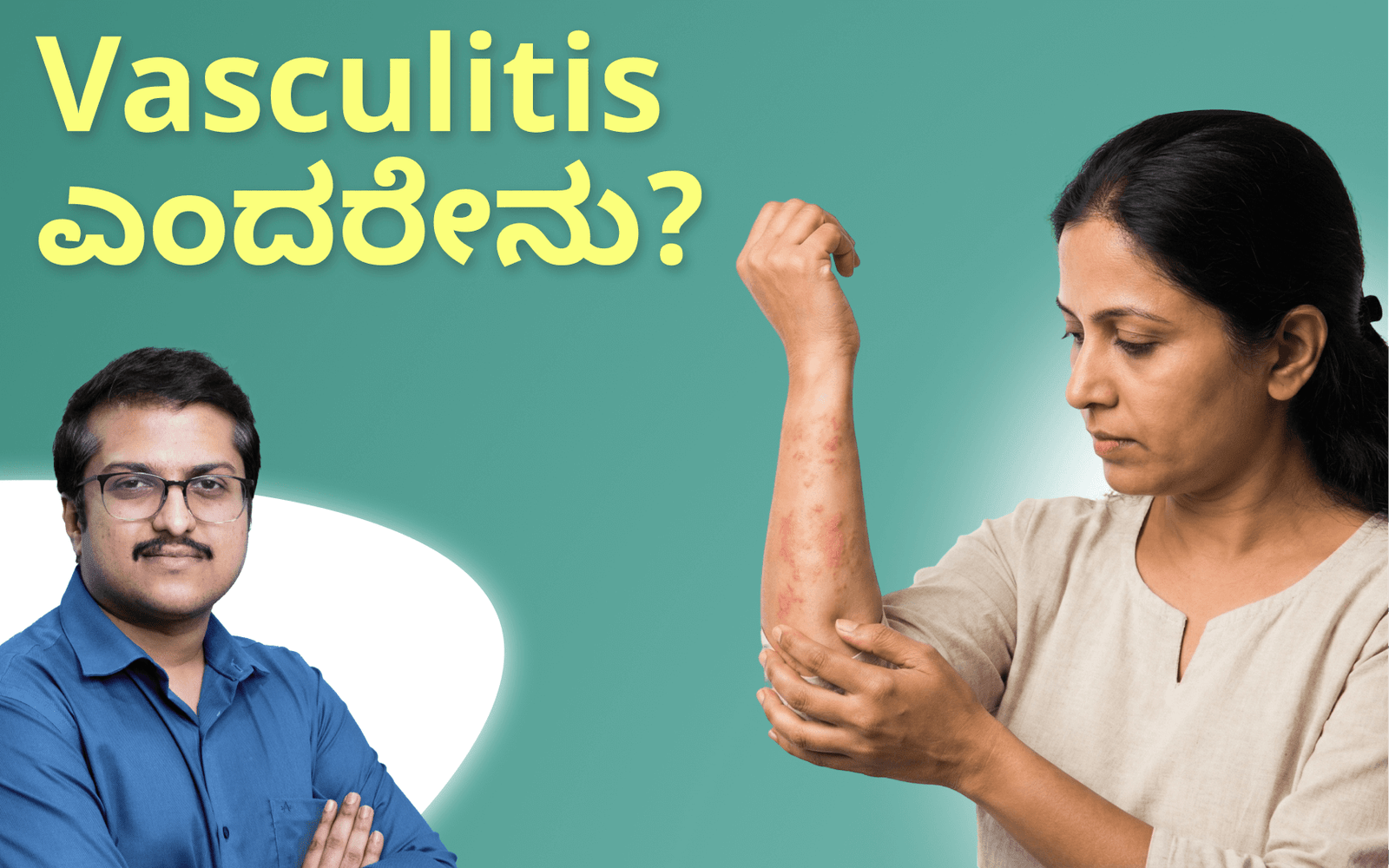 Vasculitis ಎಂದರೇನು ?? ಯಾವ ಯಾವ ಪ್ರಕಾರಗಳಿವೆ? |Dr.Rashwith Umesh |Rheumatologist